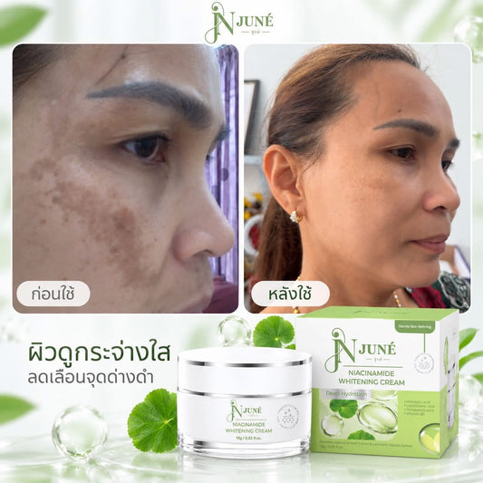Juné Niacinamide Whitening Cream – 15g