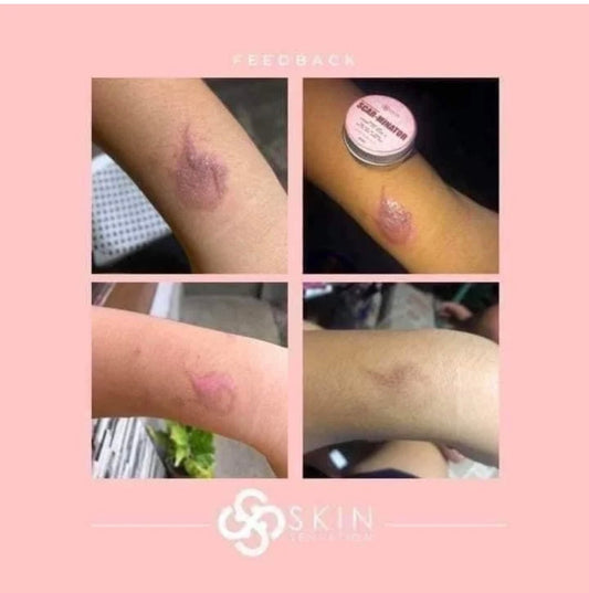 Skin Sensation New & Improved SCAR-MINATOR CREAM