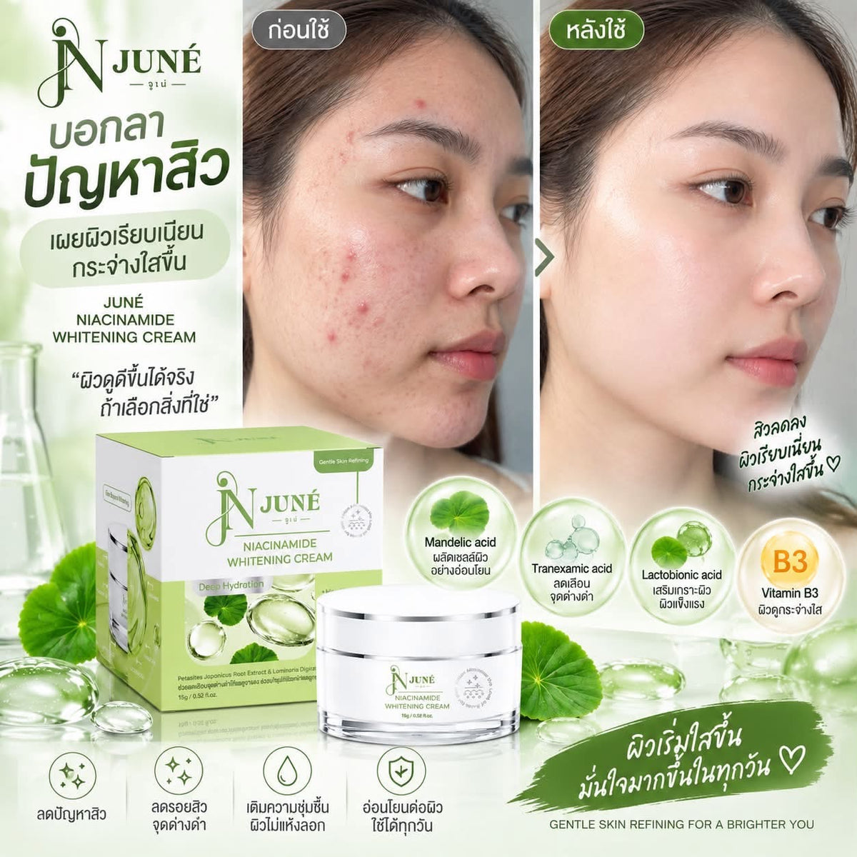 Juné Niacinamide Whitening Cream – 15g