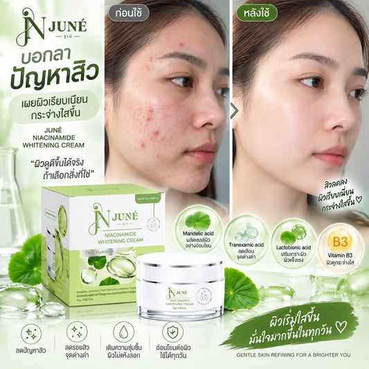 Juné Niacinamide Whitening Cream – 15g