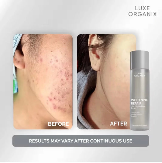 Luxe Organic Whitening Ultra Light Glow Toner