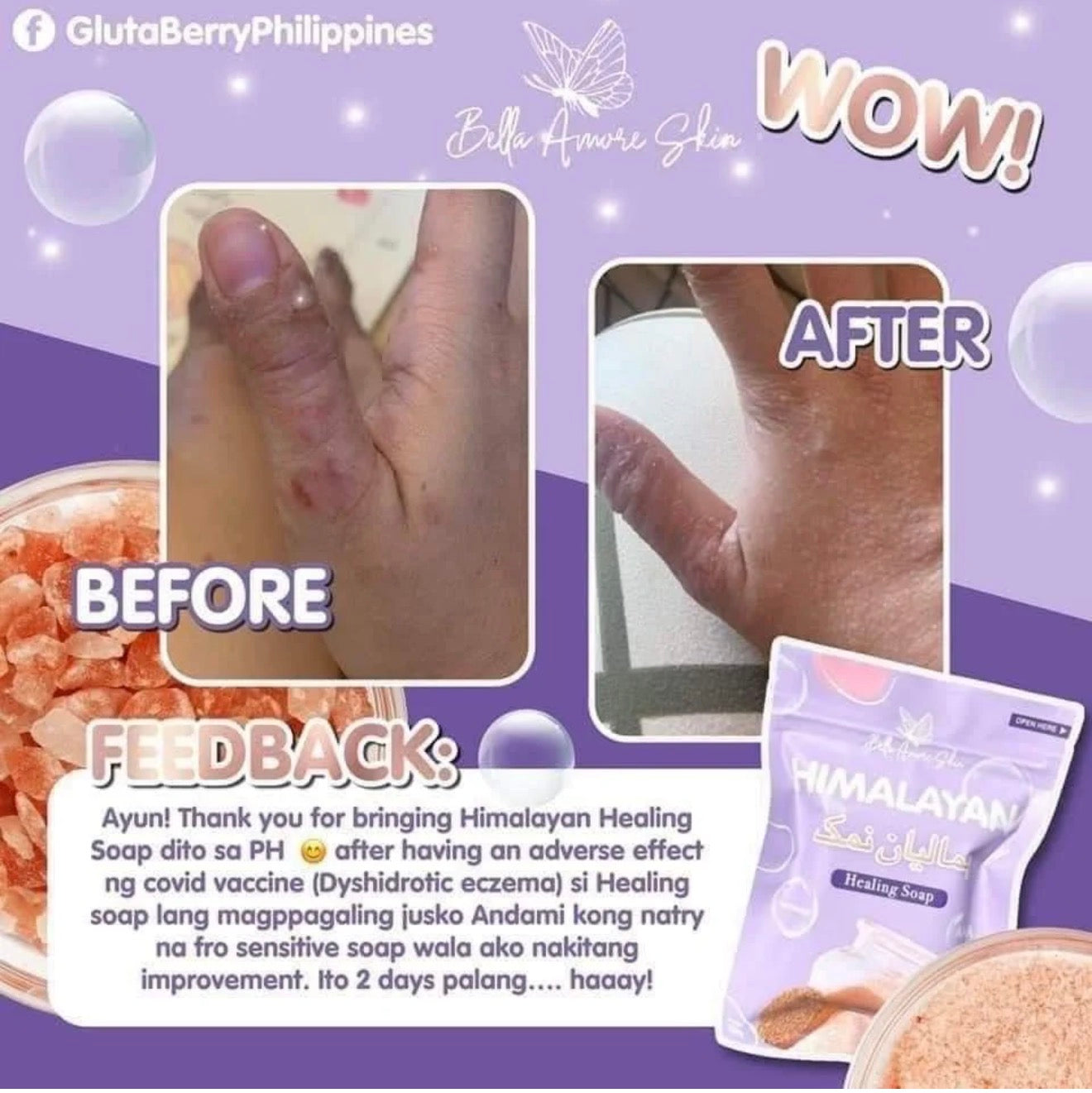 Bella Amore Skin -Himalayan Soap