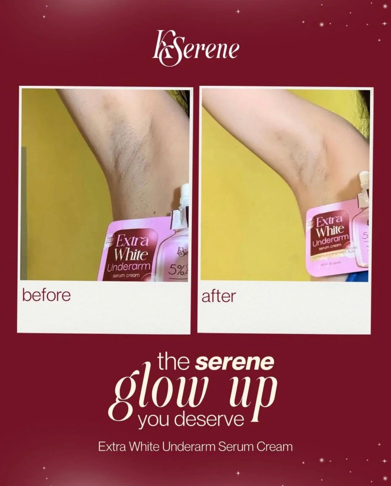 KSerene Extra White Underarm Cream