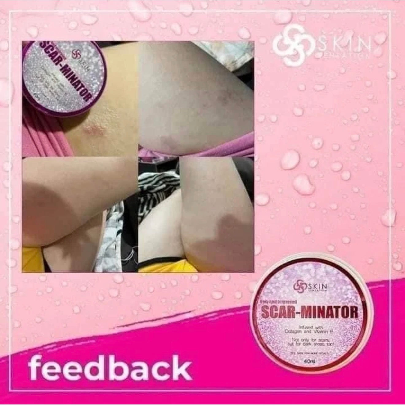 Skin Sensation New & Improved SCAR-MINATOR CREAM