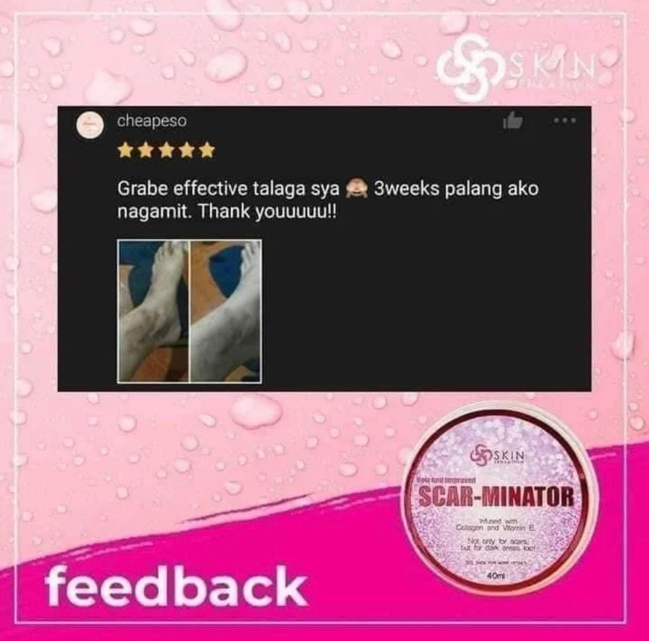 Skin Sensation New & Improved SCAR-MINATOR CREAM