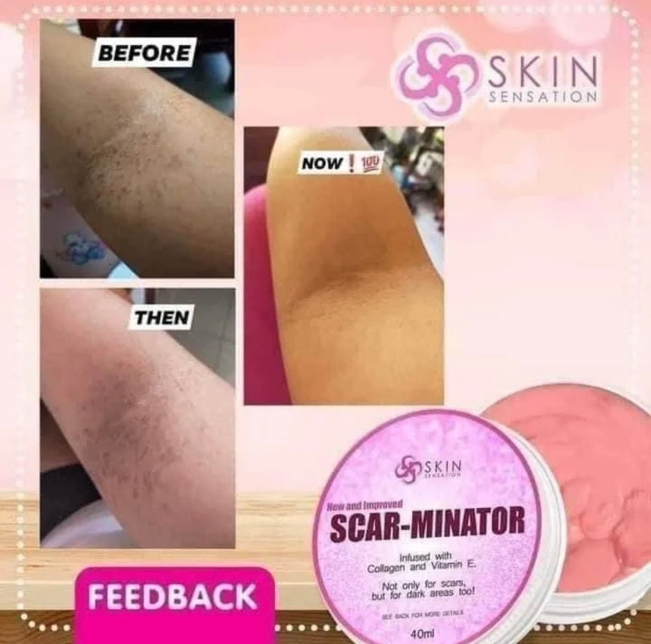 Skin Sensation New & Improved SCAR-MINATOR CREAM