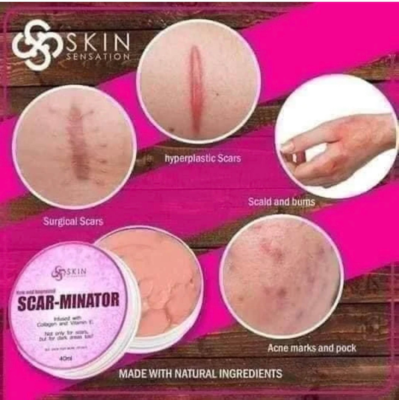 Skin Sensation New & Improved SCAR-MINATOR CREAM