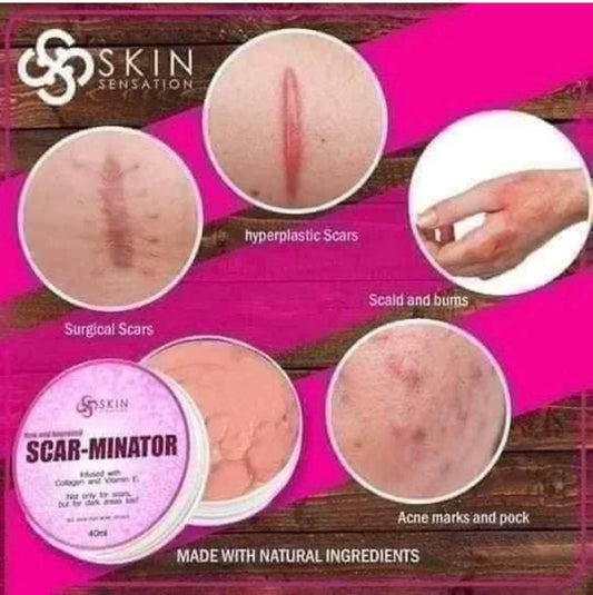 Skin Sensation New & Improved SCAR-MINATOR CREAM