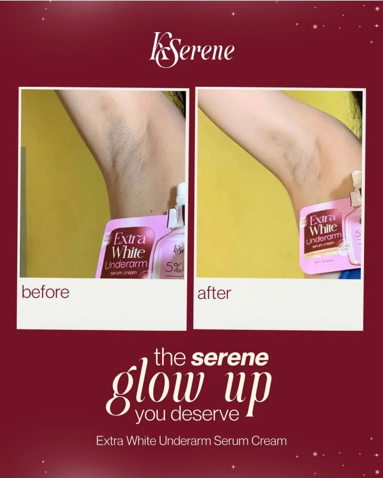 KSerene- Extra White Underarm Cream